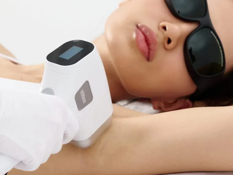 Laser Hair Removal